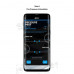 SCHWALBE Airmax - Smart Bike Sensor sada 2 kusy